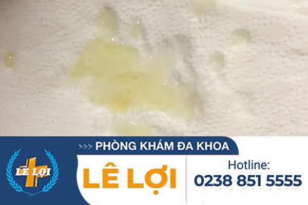 Tinh-trung-co-mau-bat-thuong